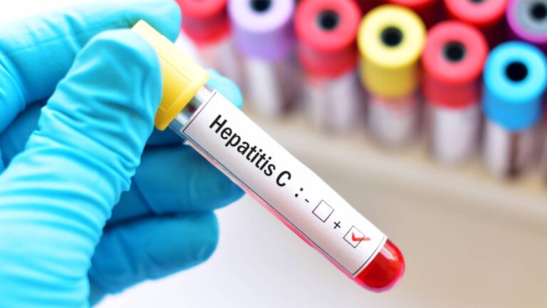 her-yil-15-milyon-insan-hepatit-nedeniyle-hayatini-kaybediyor-hMQTXScj.jpg