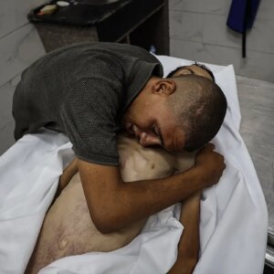 gazzede aclik faciasi 17 yasindaki cocuk hayatini kaybetti 5GR6jCGC