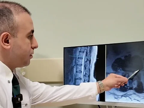 Bel Fıtığı Hakkında Önemli Uyarılar: Ameliyat Son Çare